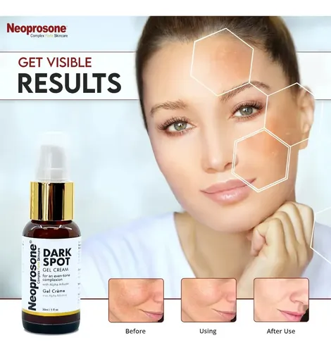 Crema Hidratante En Gel De Neoprosona Que Aclara Las Manchas Todo Tipo De Piel Día/noche
