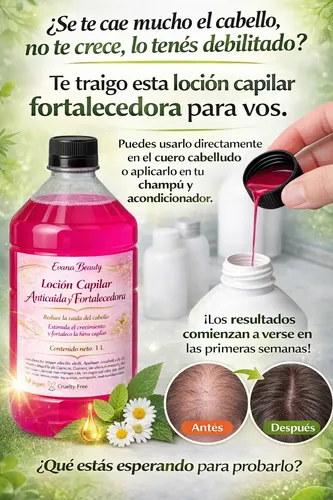 Loción Capilar Anticaída Y Crecimiento Fortalecedora 1 L