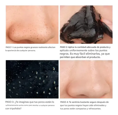 Limpieza Facial Kit Puntos Negros Rodillo Jade 3 Mascaras