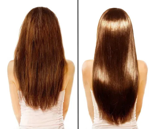 Estimulador De Raíces Para El Crecimiento Del Cabello Difeel
