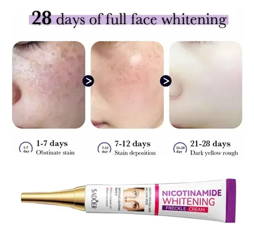 Crema Blanqueadora Facial Quita Manchas Pecas Sadoer Todo Tipo De Piel Día/noche