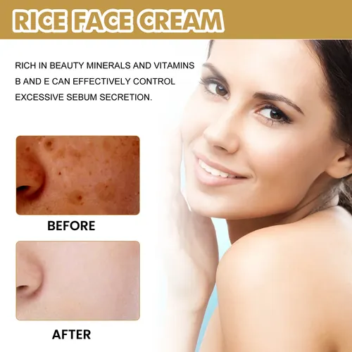 La Crema De Arroz Cuida Suavemente Las Líneas Finas De La Ca