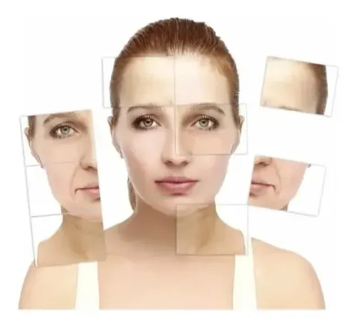 Ácido Láctico Lidherma 10% Ph 3,5 Peeling Todo El Año