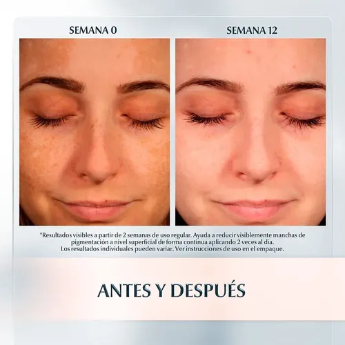 Eucerin Anti Pigment Crema Facial Fps 30 De Día Anti Manchas