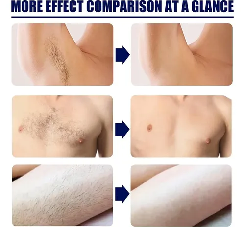 Crema Depiladora Íntima Para Hombres, No Pain, Segura,