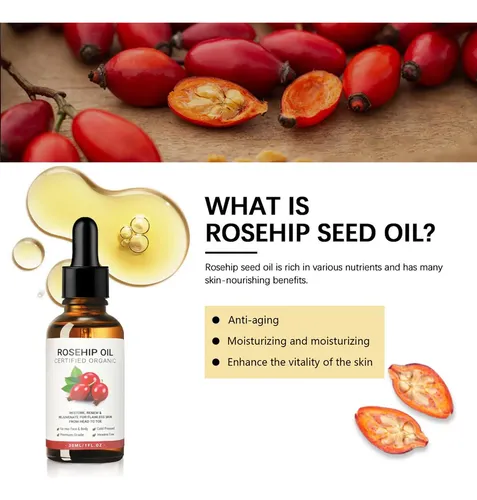 Aceite Rosa Mosqueta Hidratante Piel Rostro Cara 30ml