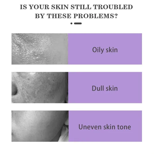 Crema Ácida: Crema Facial Hidratante Y No Pegajosa Para Una