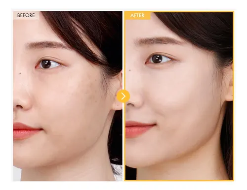 8 Days Spot Cream, Dark Spot Remover For Face, Age Spot,