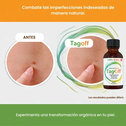 Removedor / Quita Verrugas Tag Off Skin Tag Natural