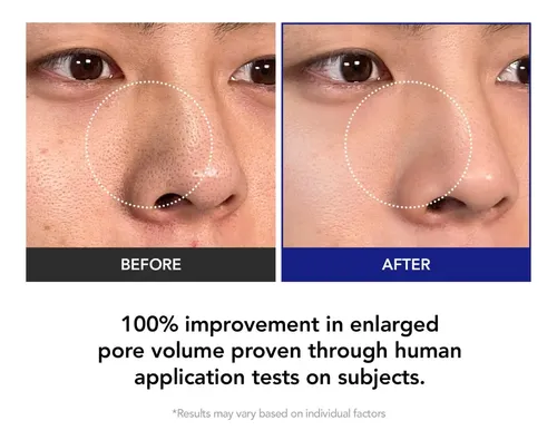 Pads Exfoliantes Ácido Salicílico Cuidado Poros 70 Todo Tipo De Piel Día/noche