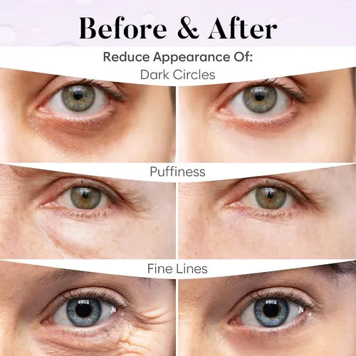 Parche De Ojos Bloomora Con Ácido Hialurónico 30 Pares