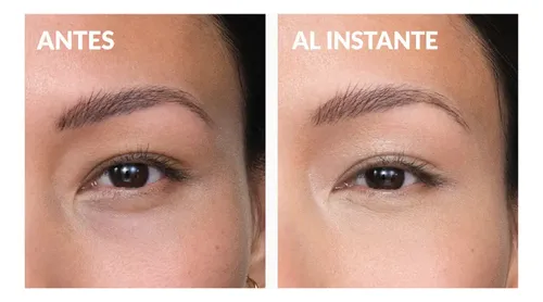 Avon Anew Contorno De Ojos Protinol Power