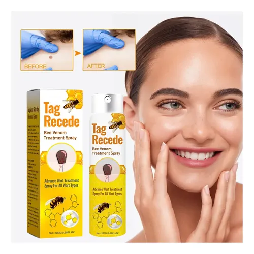 Crema Antipigmentaria Para Eliminar Las Verrugas Del Herpes,