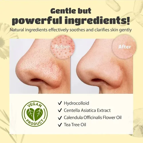 Mascarilla Tira Facial X50 Unidad Limpieza Puntos Negros