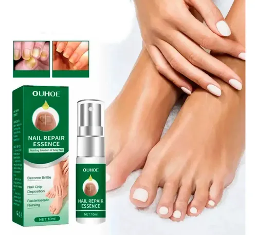 Tratamiento Uñas Hongos Piel Seca Picazón Natural Micosis