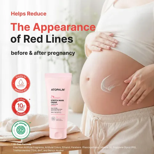 Atopalm Maternity Care Stretch Mark Cream, 150ml 5 Fl Oz,