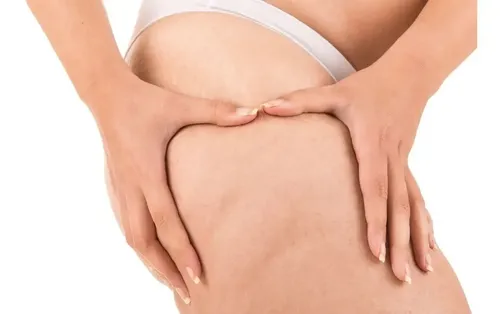 Crema Para Cuerpo Idraet Reductores Reafirmantes Lipo Sculptor En Pote 1kg