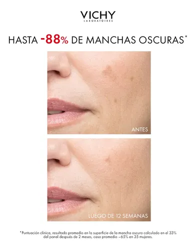 Vichy Liftactiv B3 Anti Manchas Spots Fps50 Crema 50ml