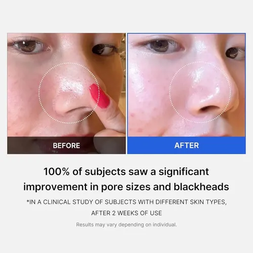 Almohadilla Medicube Zero Pore
