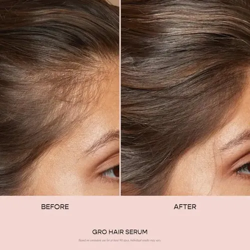 Trio Cuidado De Cabello De Vegamour Gro & Hydr-8
