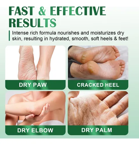 M Exfoliante Suave Para Pies Secos Y Crema Rica Para El W