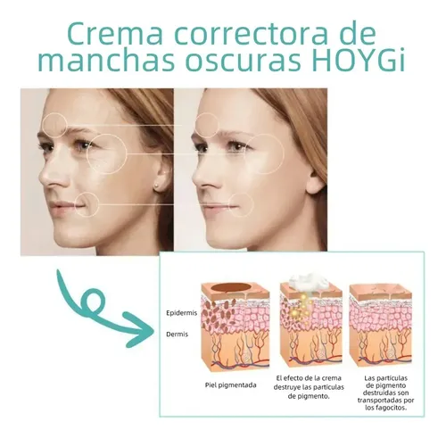 Ae La Crema Correctora De Manchas Aclara Las Manchas Oscuras