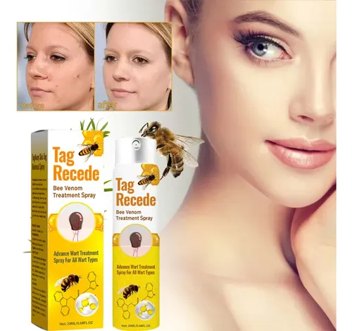 Gel De Crema Removedor De Verrugas Para Rostro Y Cuerpo, 3