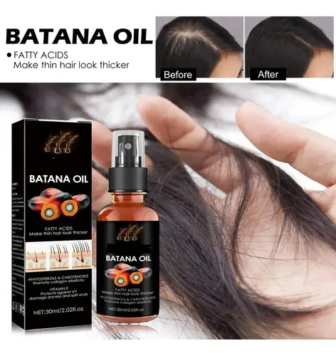 Esencia Para El Crecimiento Del Cabello Xinnuo Oil 111