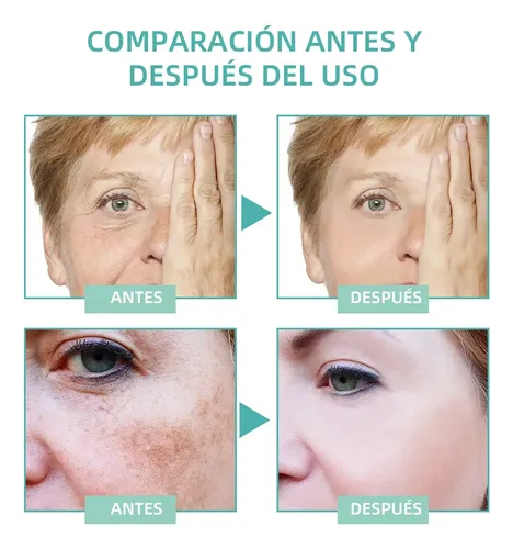 Ab La Crema Correctora De Manchas Aclara Las Manchas Oscuras