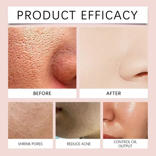 Ad Gel Exfoliante Purificante, Limpiador Exfoliante Facial,