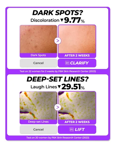 [sérum] Dermafirm Sérum Tónico Reparador Calmante R4 30ml