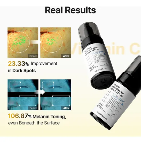 Sérum De Vitamina C Drmeditherapy Para Rostro Con Microburbu