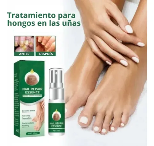 Spray Onicomicosis Tratamiento + Parche Cinta Ortesis X10 Neutra