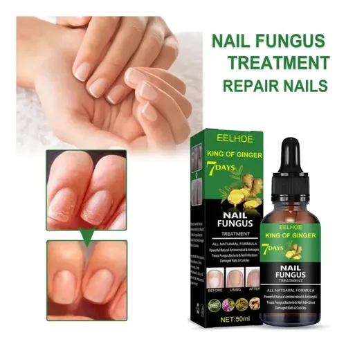 Suero Para Hongos En Las Uñas Para El Tratamiento De Uñaspd