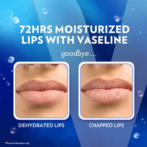 Vaseline Bálsamo Labial Original Jar 7g Importado De Corea