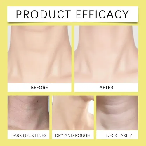 Q Crema Hidratante Para Cuello Y Escote Cuidado De La Piel
