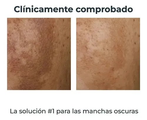 Crema Corporal Antipigmentante M* 200ml
