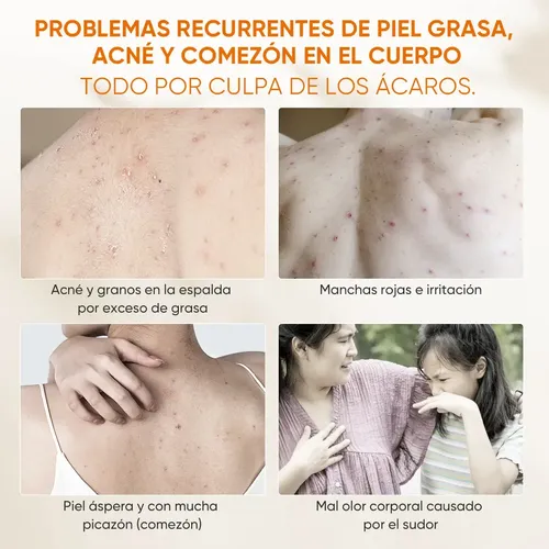 M/h Gel Corporal Limpiador Antiacné Y Ácaros 250ml Control
