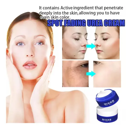Crema De Urea Para Atenuar Manchas,crema De Urea Para Rostro