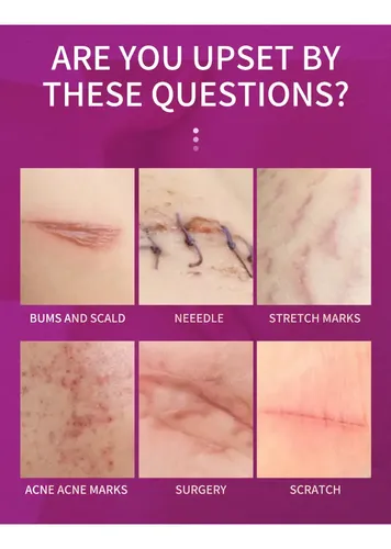 Crema Para Cicatrices Qanzire Hidratante Acido Hialurónico
