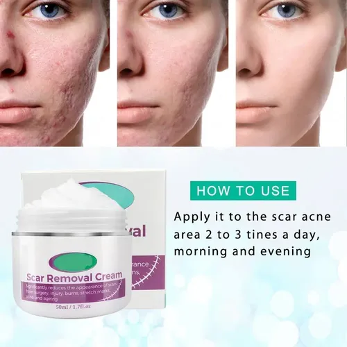 Crema For Eliminar Cicatrices Y Estrías, Alivio Y Quemaduras