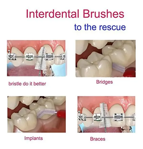 . 50 Cepillos De Dientes Suaves, Cepillos De Limpieza Bucal