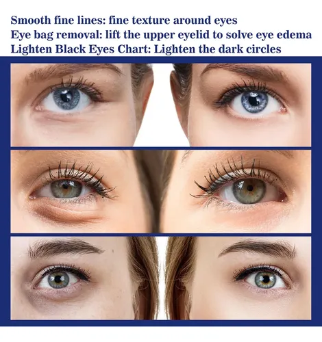 2 Unidades Crema Para Ojos Dos Minutos Para Quitar Bolsas