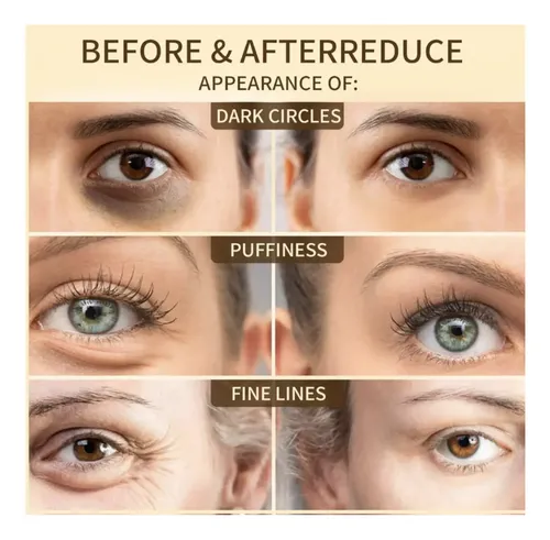 Parches De Colageno Párpados Ojeras X 10u Ojos Antiarrugas Tipo de piel Todo tipo de piel
