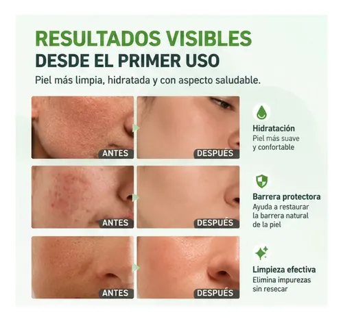+limpiador Facial Hidratante Y Reparador Para Piel Seca, 236