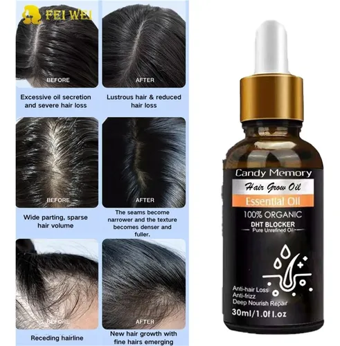 Aceite Capilar Con Extracto De Jengibre (pack De Dos)