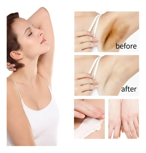 A. Crema Blanqueadora De La Piel Crema Blanqueadora Para