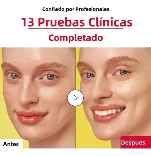 Sdfs Jfghh Vc Essence Mejora La Opacidad Descuento