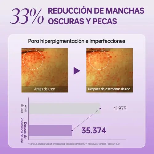 Mary&amp;may Crema De Ojos Antimanchas Txa + Glutatin J