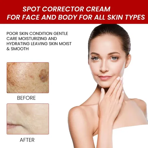 Crema Facial Hidratante For Manchas De Pigmento Aclarante